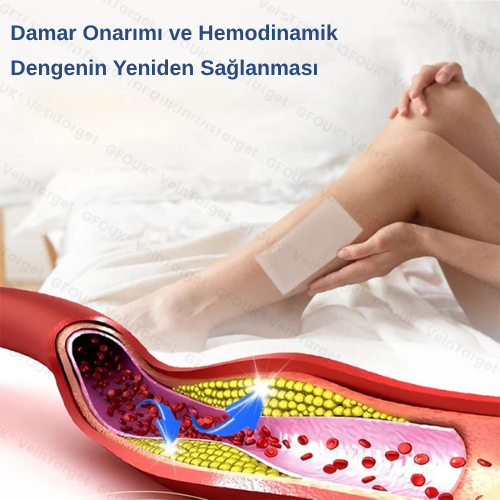 Mikroiğneli Varis Bandı