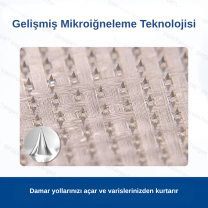 Mikroiğneli Varis Bandı