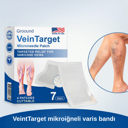 Mikroiğneli Varis Bandı